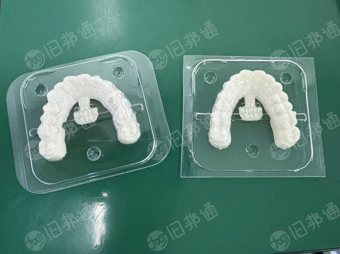 出售tpu牙套毛料，有纯tpu的，也有复合pet的，纯的有200吨/年，复合的800吨/年