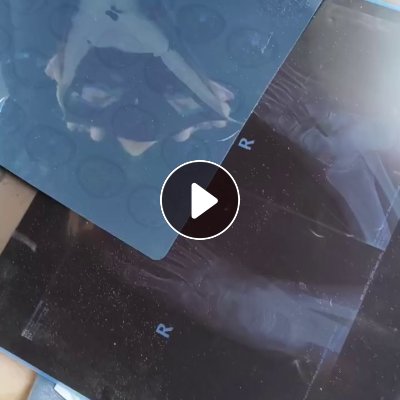 出售旧CT片，旧CT,货在山西晋城